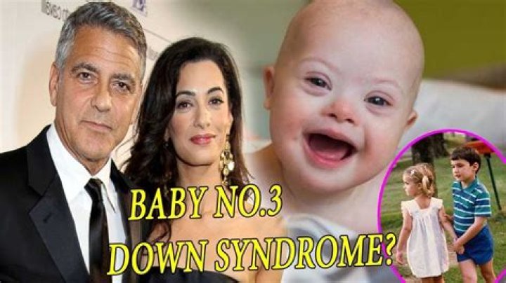 Unveiling The Journey Of George Clooney's Twins With Down Syndrome: Discoveries And Insights