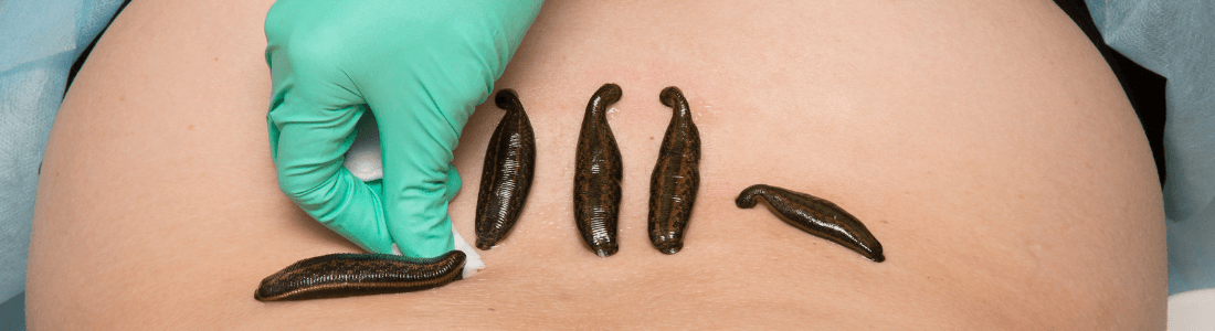 Medicinal Leeches