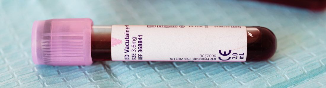 Tube of blood following a blood test