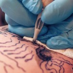 Tattoos like this can trigger CRPS in susceptible people